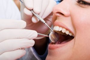 Dental Insurance in Eunice, Lafayette, Crowley, Opelousas, Landry Parish, LA